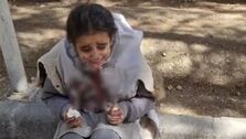ماجرای دختر دانش‌آموز اصفهانی با صورت خون‌آلود چه بود؟+ فیلم