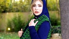 عکس وحشتناک نیوشا ضیغمی قبل از عمل/از چی، چی ساخته!!!+عکس