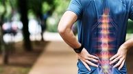 علائم شدید دیسک کمر: چه زمان جراحی تنها درمان است؟