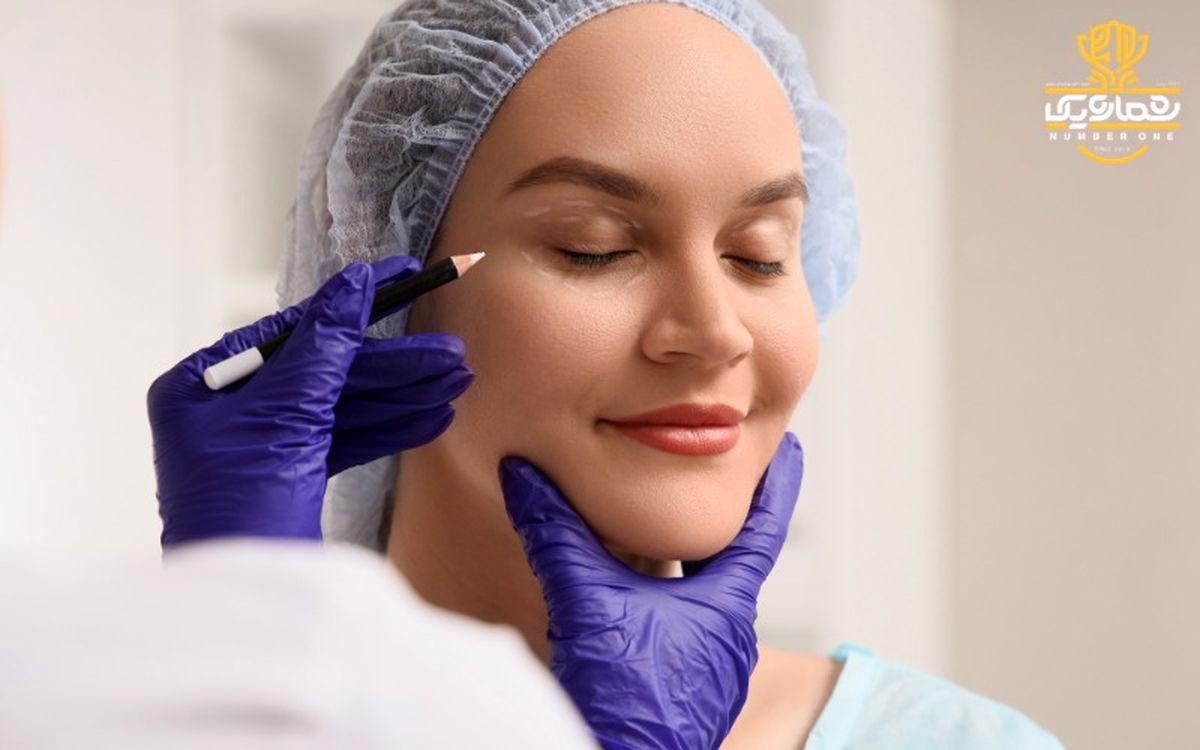 قبل از انجام بلفاروپلاستی این ۵ حقیقت را بدانید