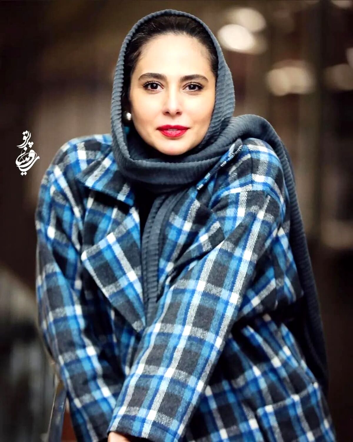 خنده های زیبای رعنا آزادی ور بازیگر زخم کاری + عکس