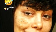 عکس لو رفته از چهره داغون و شکسته سحر قریشی همه رو شوکه کرد