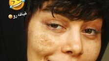 عکس لو رفته از چهره داغون و شکسته سحر قریشی همه رو شوکه کرد