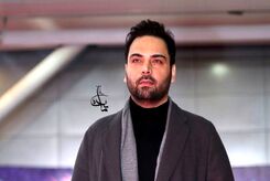 چهره قبل از عمل احسان علیخانی سوژه شد! +تصاویر باورنکردنی