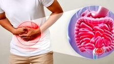 با این روش خانگی یبوست را سریع درمان کنید+راهکار